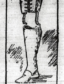 Illustration of an artificial leg