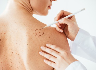 image of health care worker mapping spots on a patient's back