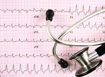 image of a stethascope on ecg report